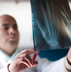 Osteoporosis Prevention